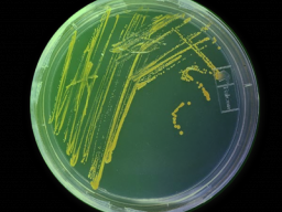 Webinar: Infektiologie