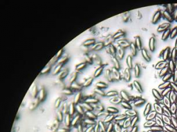 Webinar: Zeitgemäßes Endoparasitenmanagement für Pferde