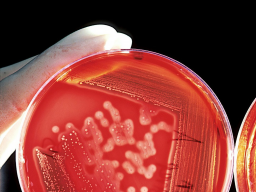 Webinar: Hygiene: Gestaltung der Folgebelehrung nach IfsG