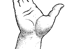 Webinar: Angststörungen: Handdiagnose und Therapiemöglichkeiten