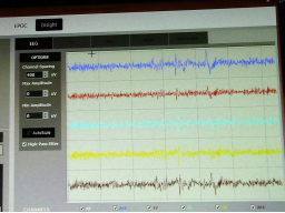Webinar: GPS zu Lebenszielen
