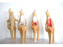 Webinar: Arthrose beim Hund