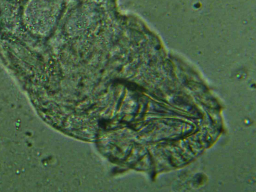 Webinar: Der Koi und seine Parasiten