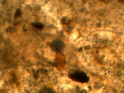Webinar: Innenparasiten bei Koi