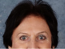Webinar: Gesichtsmuskeltraining! Aber wie? II ÜE Oberlider, Unterlider, Wangen straffen "leicht und effektiv!"