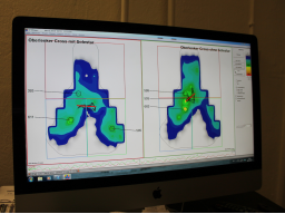 Webinar: Bike Fitting - Die Vorteile der optimierten Sitzposition auf dem Rad